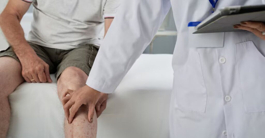 Knee arthroscopy in Indore, arthroscopic knee surgery